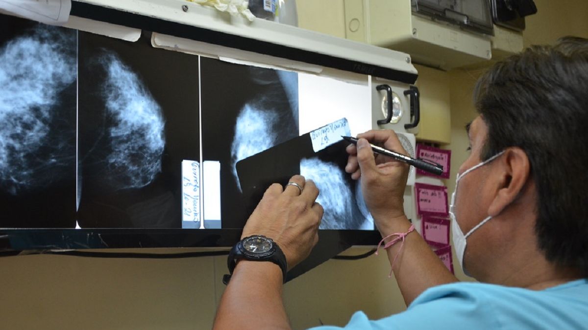 San Juan ofrecerá mamografías gratuitas para mujeres sin obra social